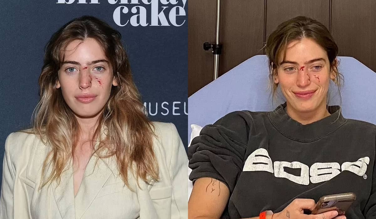 Filha de Ewan McGregor posa com o rosto mordido por cachorro em tapete vermelho