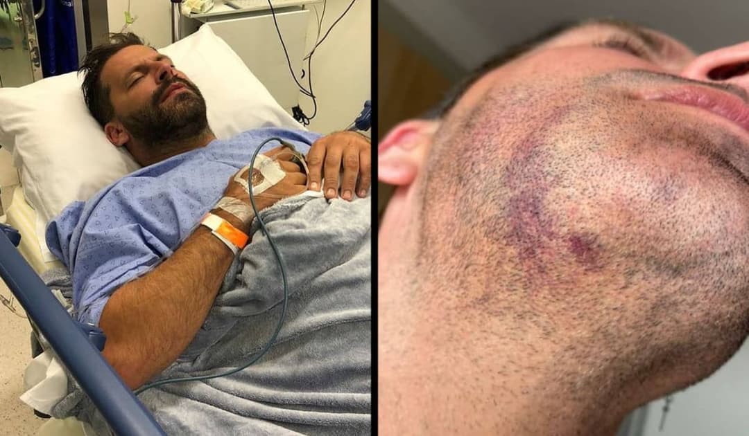 Caso Henri Castelli: Agressores que espancaram o ator seriam amigos de prefeito