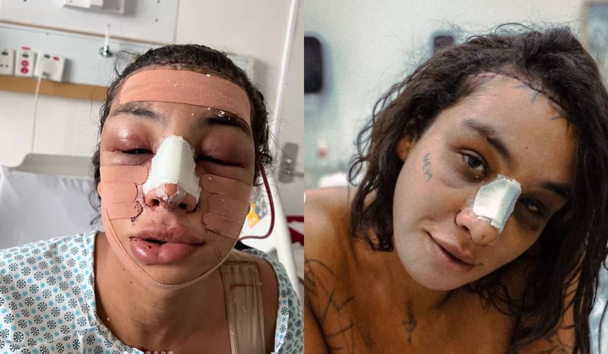 Após procedimentos cirúrgicos, Lina preocupa fãs nas redes sociais