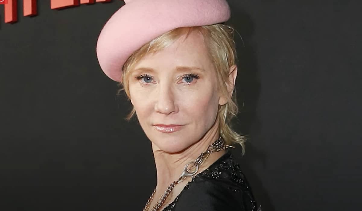 Anne Heche: Representante revela lesão cerebral grave e diz que 'não é esperado' que atriz sobreviva